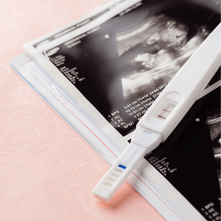 A pregnancy test and sonogram photo on a light pink background